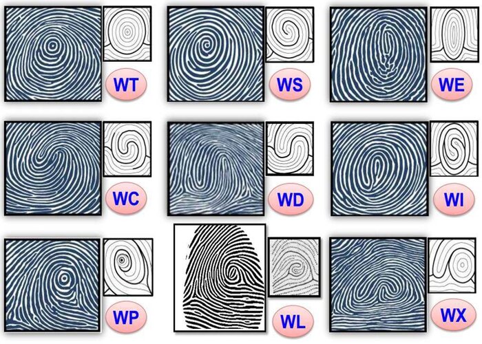 Chủng v&acirc;n tay Whorl
