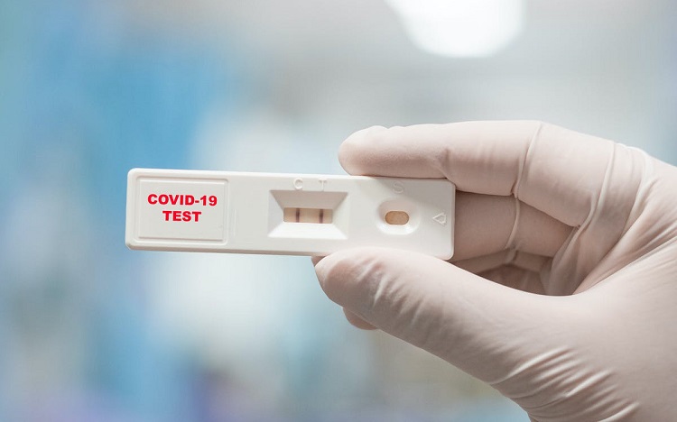  test nhanh Covid-19