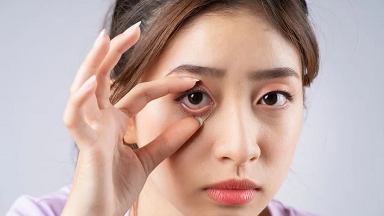 Cải thiện thị lực