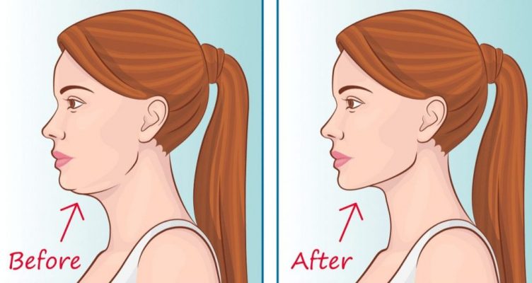 Một số c&acirc;u hỏi thường gặp về phương ph&aacute;p Mewing