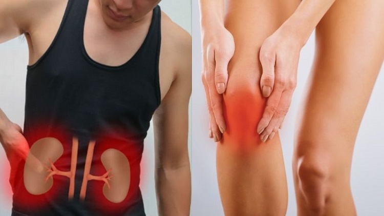 Người bị bệnh gout v&agrave; rối loạn thận kh&ocirc;ng n&ecirc;n ăn