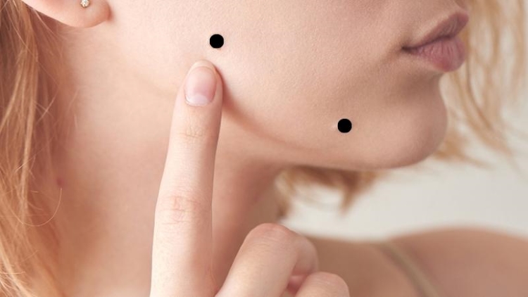 Nhân tướng nốt ruồi ở mông của phụ nữ và đàn ông nói lên điều gì?